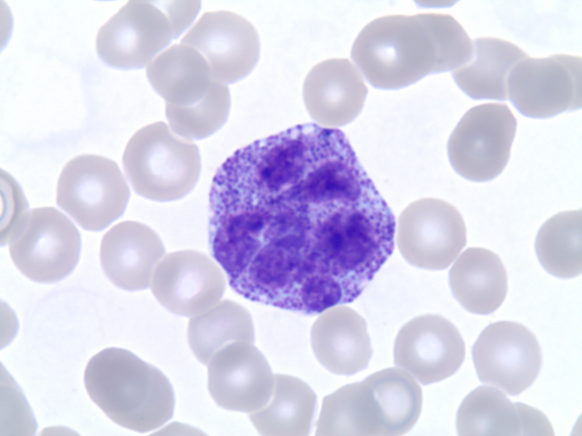 Hypersegmented basophil, bone marrow 1000x
